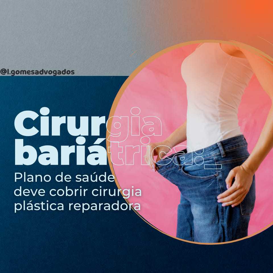 Cirurgia Bariátrica e Cobertura pelo Plano de Saúde.